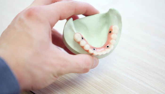 When You Need a Fixed Denture and not an Implant
